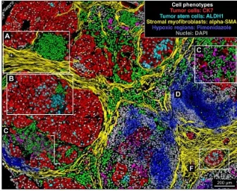 Spatial heterogeneity in cancer